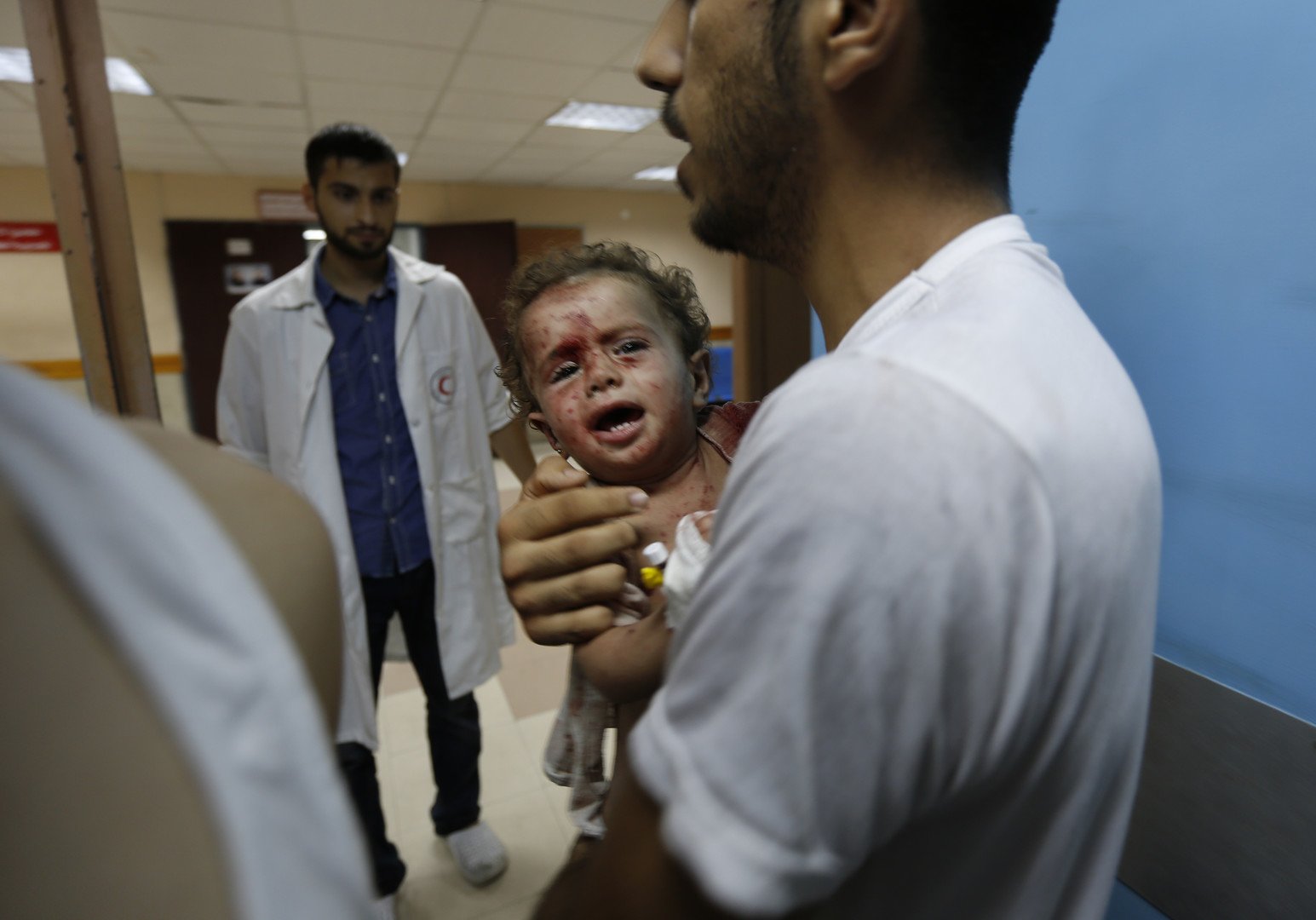  طفل يتلقى العلاج في مشفى الشفاء في غزة، 18 يوليو