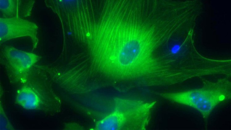 تخليق معدة بشرية لأول مرة داخل المختبرات باستخدام الخلايا الجذعية