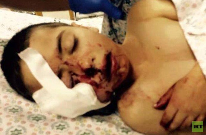 جندي إسرائيلي يصيب طفلا فلسطينيا برصاصة في الوجه