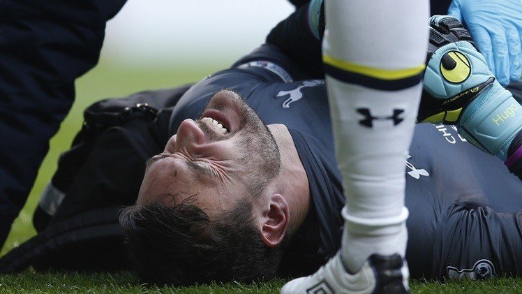 استبعاد القائد لوريس من تشكيلة الديوك