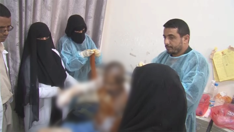 فيديو... مستشفيات صنعاء مكتظة بالجرحى
