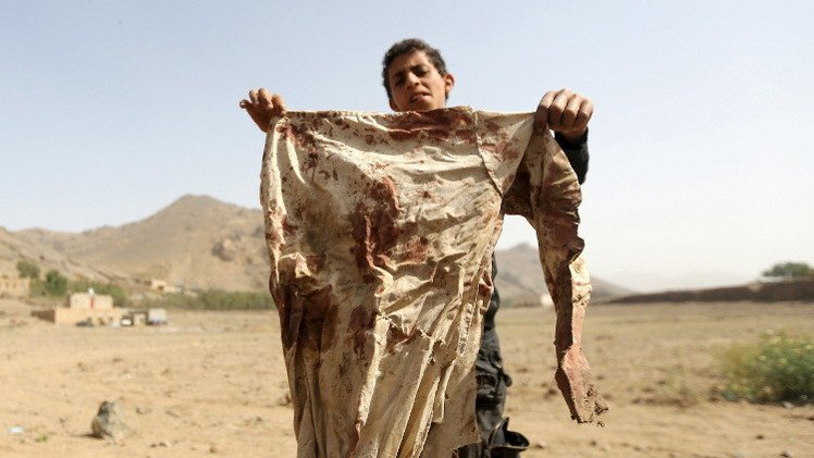 اليونيسف: مقتل 279 طفلا باليمن منذ 26 مارس/آذار 