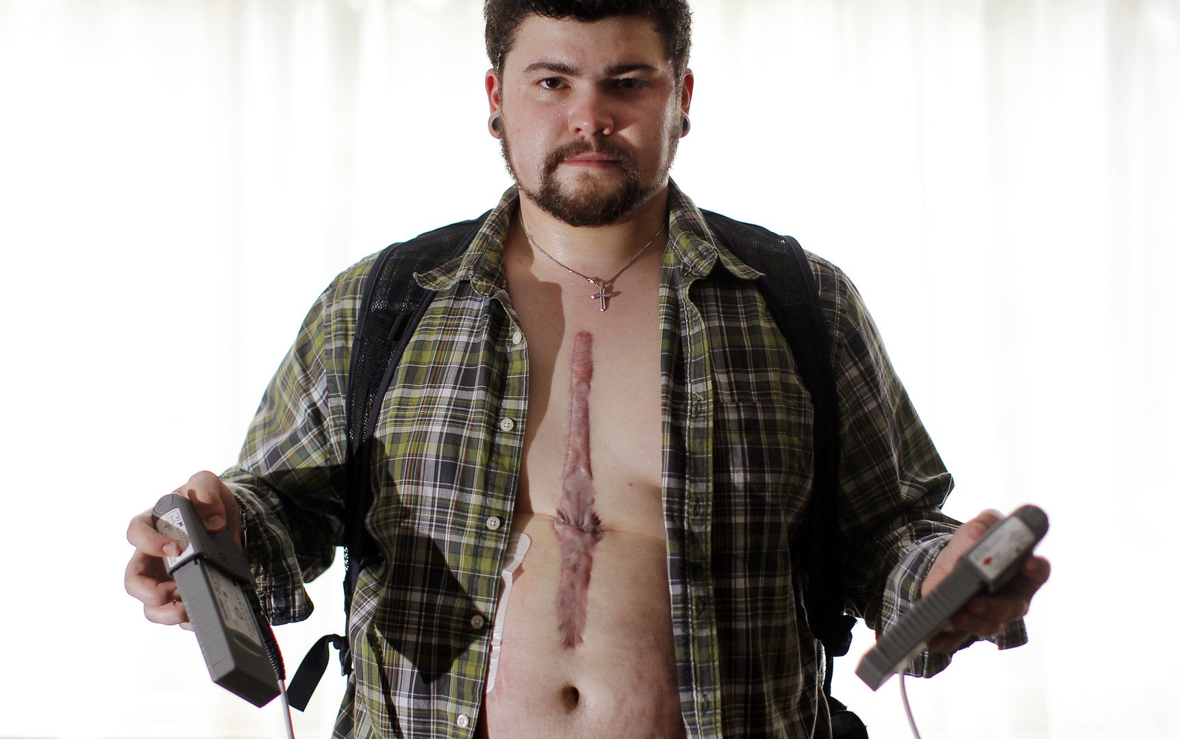 دان روث في صورة له ببطارية جهاز ضخ الدم خلال الدورة الدموية للجسم المثبت داخل جسده 23 سبتمبر 2010