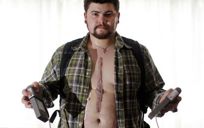 دان روث في صورة له ببطارية جهاز ضخ الدم خلال الدورة الدموية للجسم المثبت داخل جسده 23 سبتمبر 2010