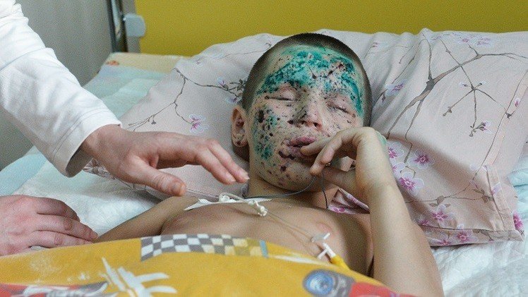 منظمة الصحة العالمية: 250 طفلا ضحايا النزاع شرقي أوكرانيا منذ اندلاعه 