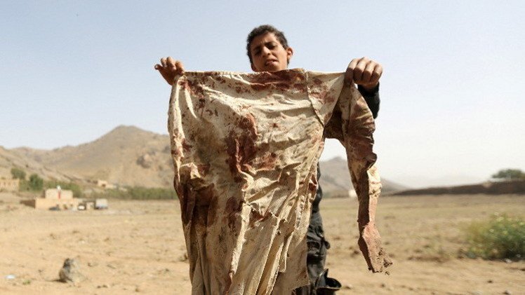 منظمات حقوقية تطلب من الأمم المتحدة التحقيق في انتهاكات محتملة باليمن