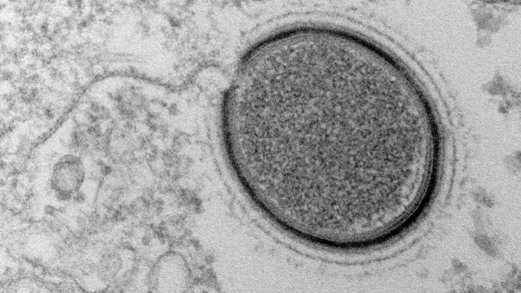 العلماء يكتشفون فيروسا عملاقا عمره 30 ألف سنة ويخططون لإعادته للحياة