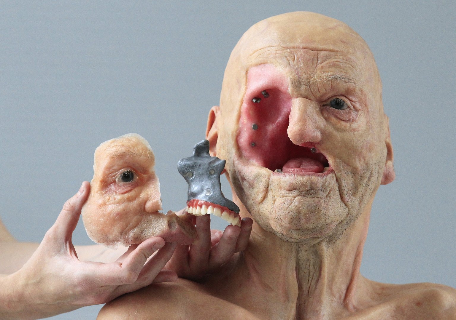 صورة ثلاثية الأبعاد لجراحة تقويمية معقدة أنشئت بالتعاون مع الجراح جان دي كوبر في شركة بلجيكية باستعمال أكبر آلة ثلاثية الأبعاد بأوروبا، لوفين 24 يناير/كانون الثاني 2013.