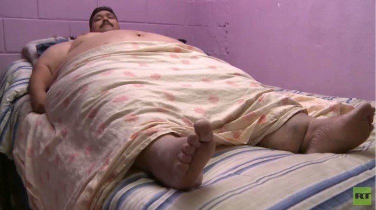 بالفيديو من المكسيك.. أسمن رجل في العالم تحت مشرط الجراح لتصغير معدته