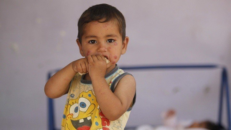 وباء الإرهاب ووباء "اللشمانيا" يعصفان بالمدن السورية و"داعش" السبب