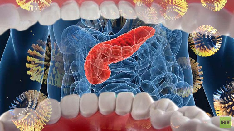 بكتيريا فموية مؤشر على الإصابة بسرطان البنكرياس