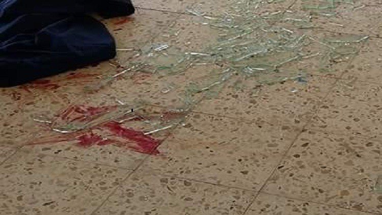 القاعدة تبدأ بتصفية قيادات المقاومة في جنوب اليمن