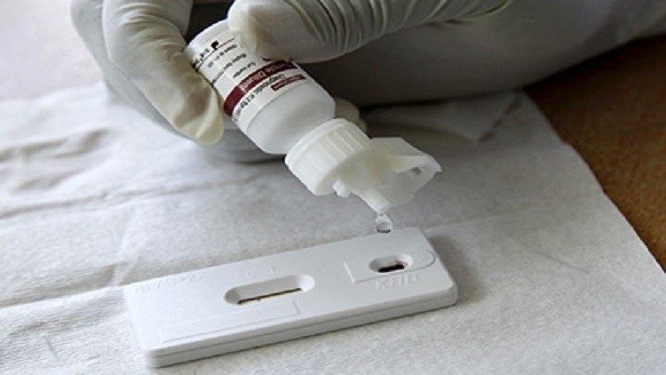 علماء يتوصلون إلى طريقة فعالة للقضاء على الإيدز