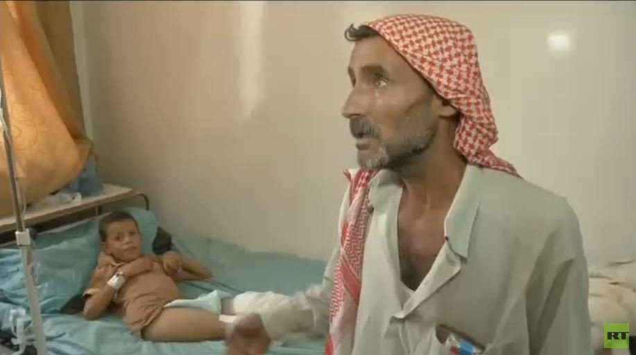 مأساة إنسانية.. طفل أصم وأبكم يفقد ساقيه بقصف في حلب!