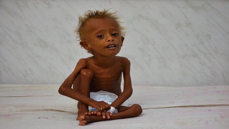 تقرير: اليمن مهدد بالمجاعة والانهيار!
