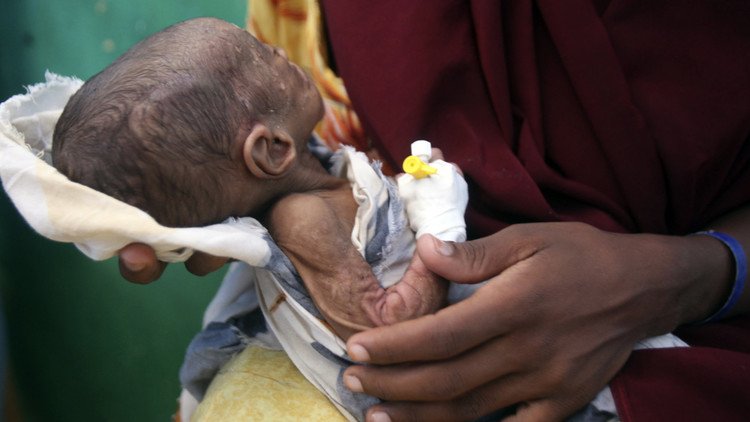 20 مليونا قد يموتون جوعا خلال نصف عام