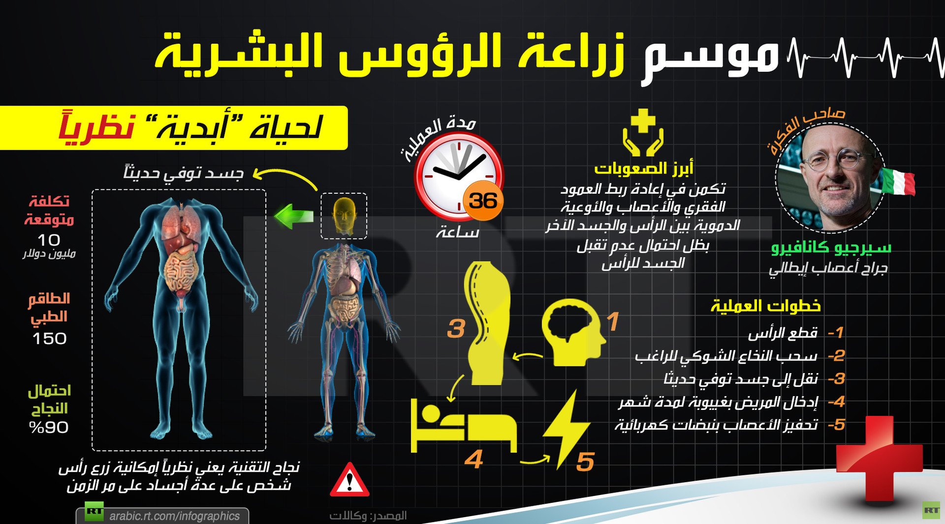 عملية زراعة أول رأس بشري