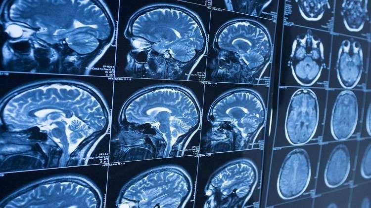 ما علاقة هيكل الدماغ بمعدل الذكاء؟