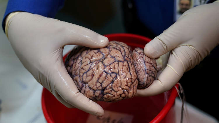 ابتكار غرسة (رقاقة) لتحفيز الدماغ