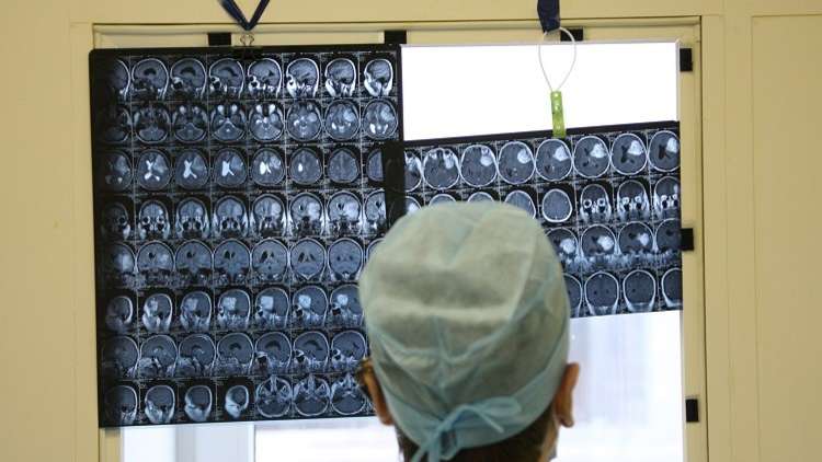 جراحون هنود ينجحون في إزالة أكبر ورم دماغي 