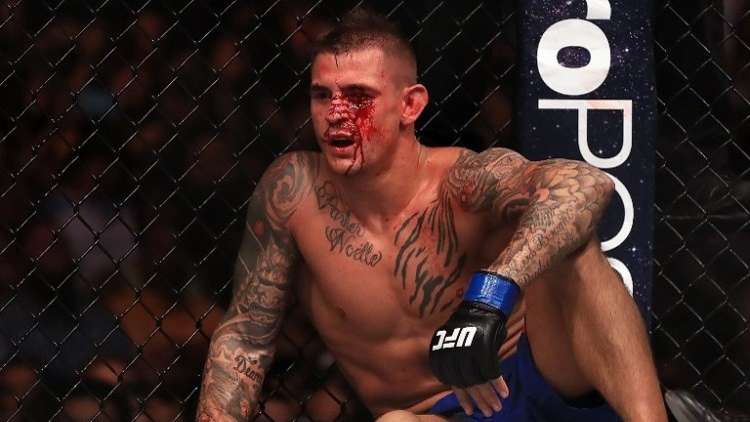 شاهد.. مقاتل يوجه ضربة "خلفية مزدوجة" لخصمه