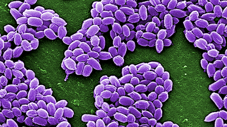 الجمرة الخبيثة تظهر في مقاطعتين شمالي الصين!