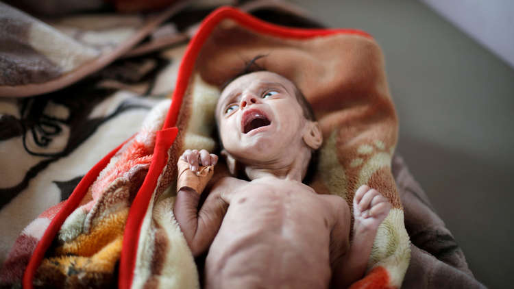 الأمم المتحدة: اليمنيون يهلكون جوعا جماعات وفرادى