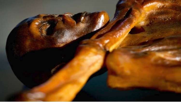 مومياء أوتزي تكشف تطورا طبيا مذهلا قبل 5300 عام