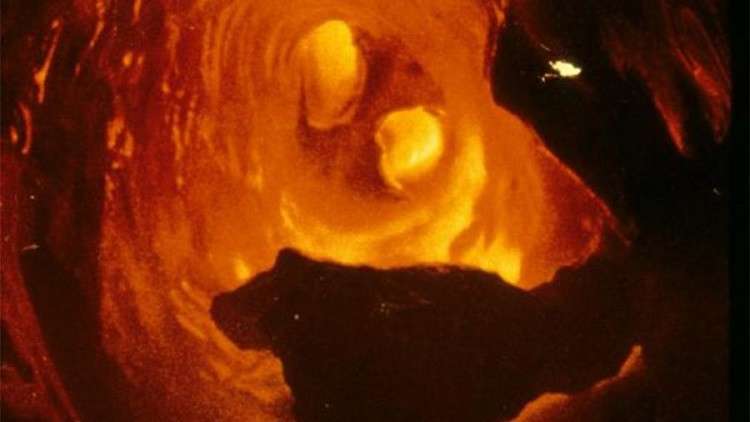 3 أسباب رئيسية لتكون لويحات الكوليسترول في الأوعية الدموية