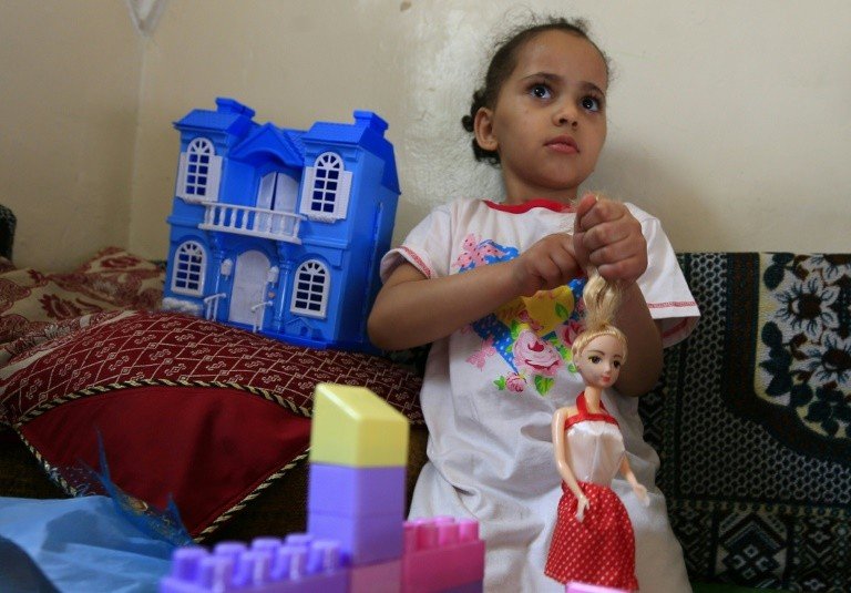 صورة عفوية مؤثرة لطفلة يمنية جعلتها أحد رموز النزاع المدمر في البلد الفقير