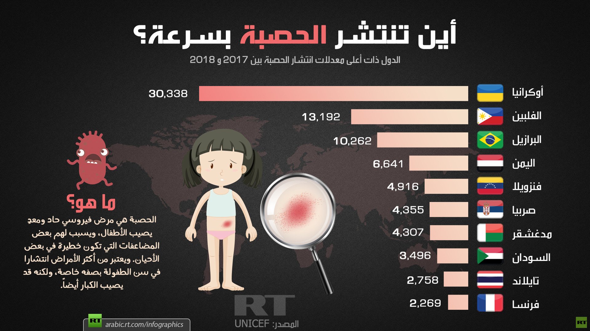 أين تنتشر الحصبة بسرعة؟