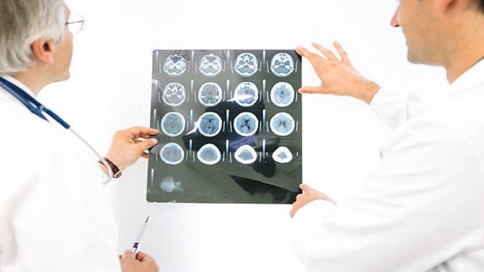 ألزهايمر يبدأ في مرحلة الطفولة!