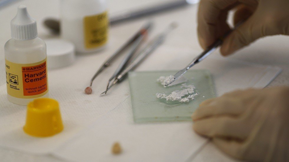 شاهد.. أطباء يقتلعون 526 سنا من فم طفل هندي