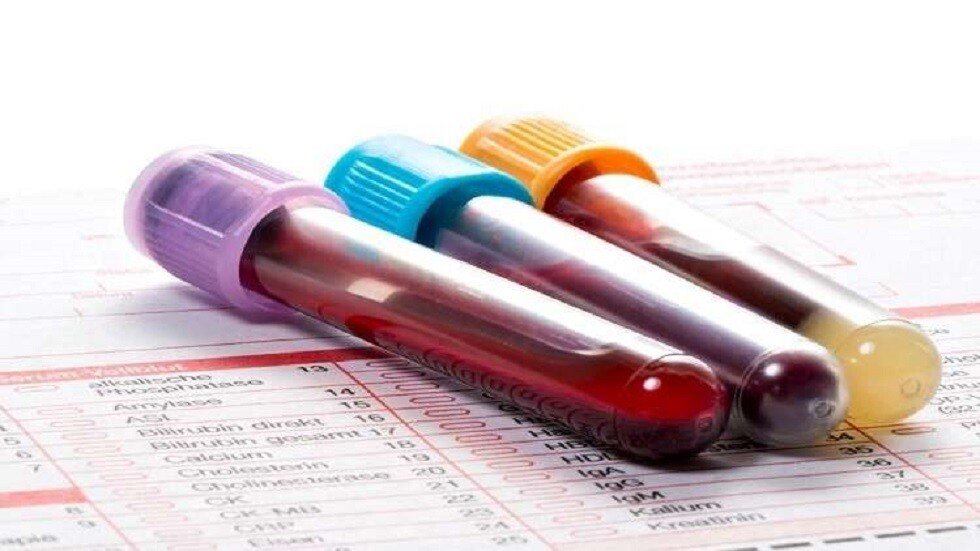 اختبار دم يتنبأ بمخاطر الوفاة المبكرة قبل 40 عاما