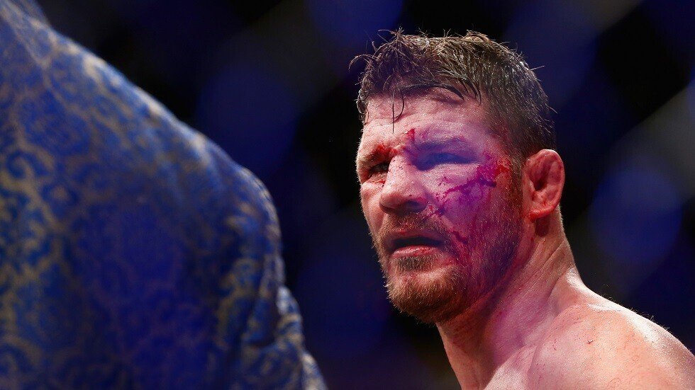 مقاتل (UFC) ينشر فيديو لاقتلاعه عينه الاصطناعية وصورة لركبته أثناء عملية جراحية!