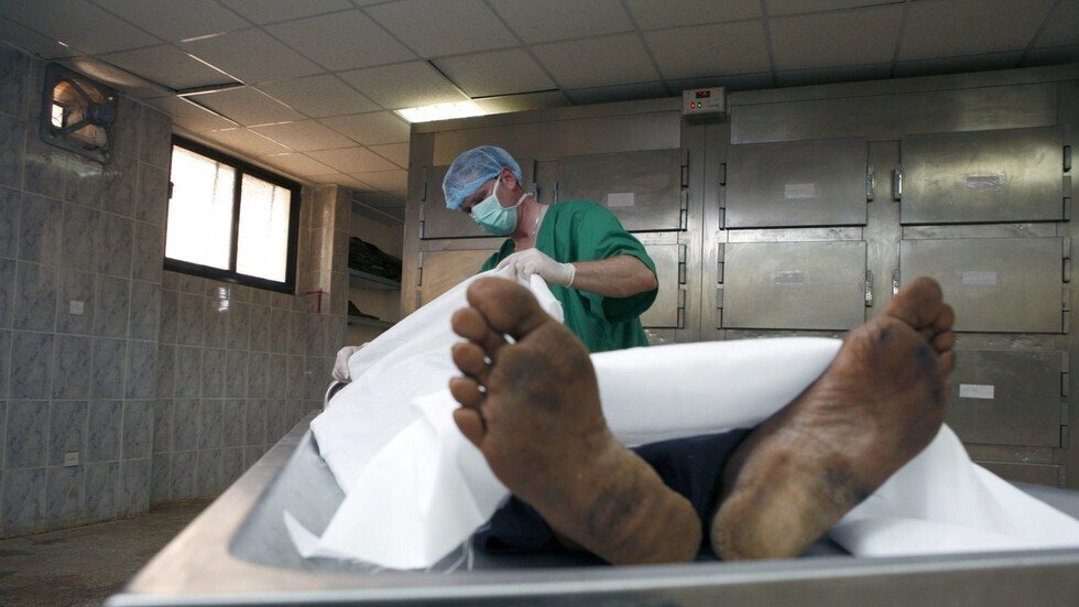 هندية تموت مرتين بسبب حالة نادرة الحدوث حول العالم