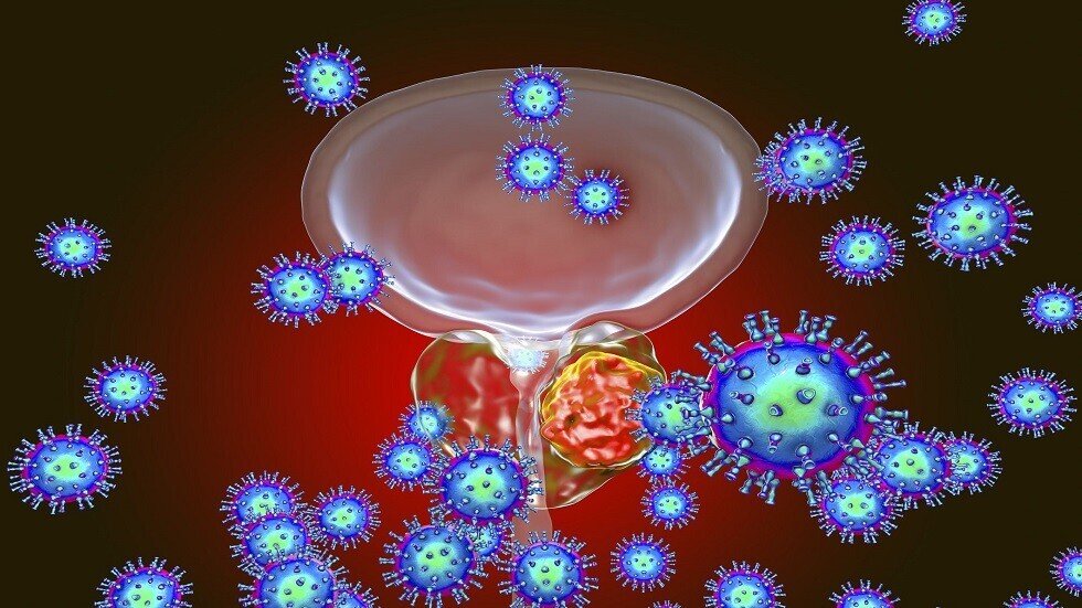 منتجات غذائية شائعة قد تزيد خطر إصابة الرجال بسرطان قاتل