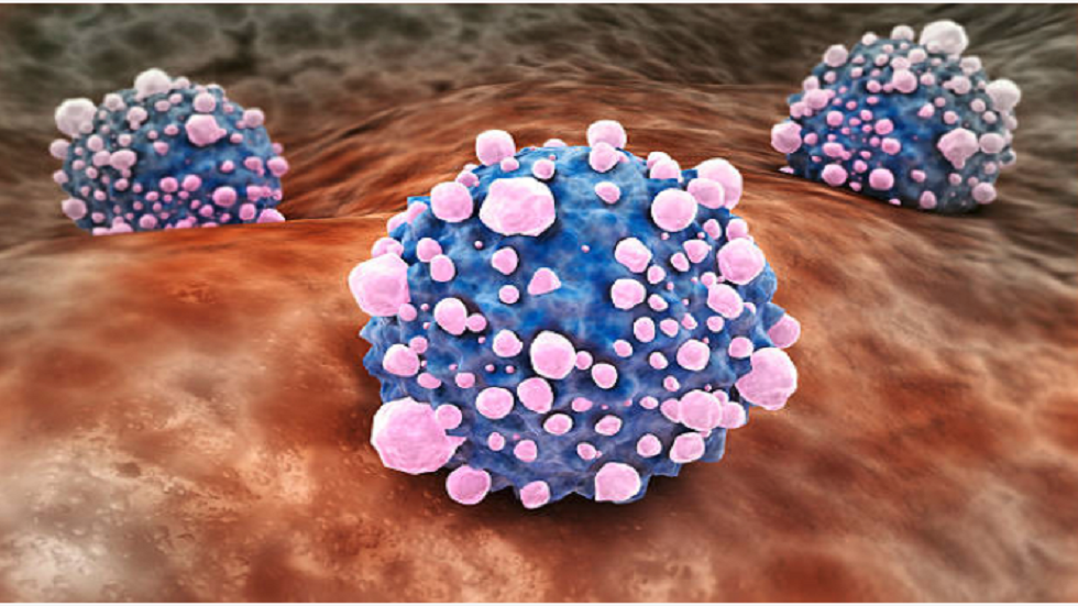 الشعور بالألم في منطقة معينة من الجسم ينذر بسرطان قاتل!