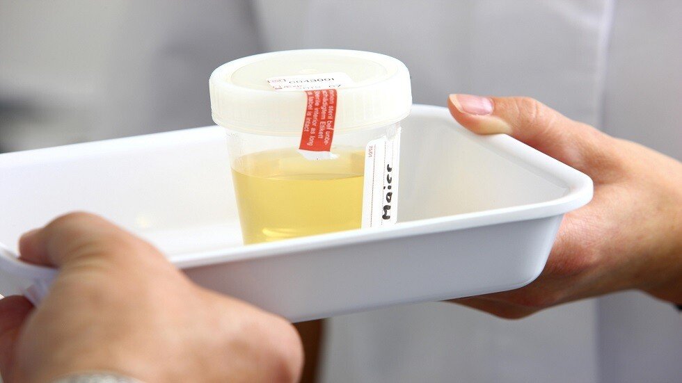 اختبار جديد لتشخيص سرطان البروستاتا في المنزل