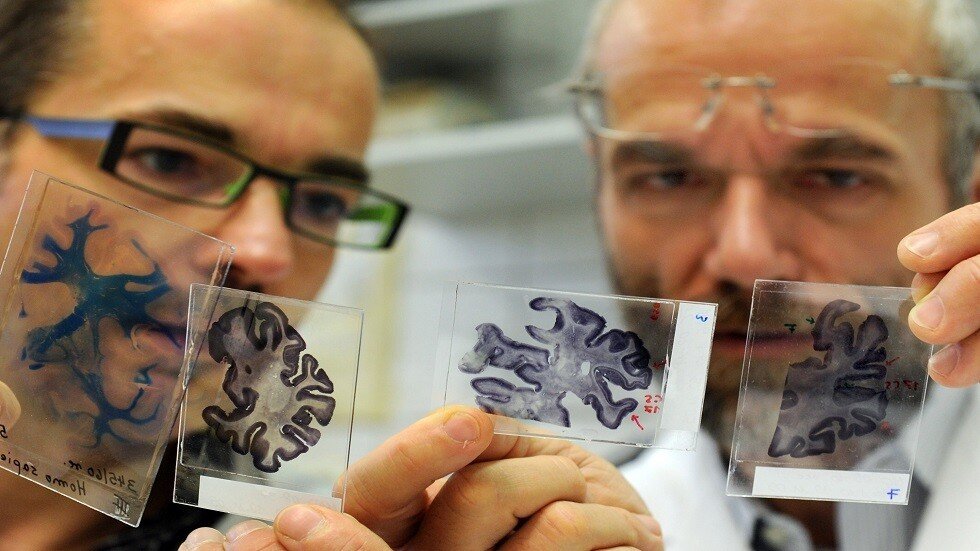 اكتشاف وسيلة مضادة لموت الدماغ