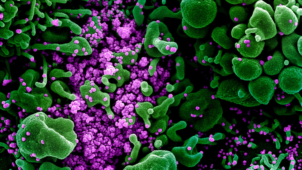 تركيا تعلن عن 14 مشروعا لتطوير لقاحات وأدوية مضادة لفيروس كورونا المستجد