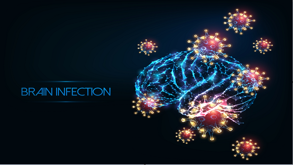 مريضة بـCOVID-19 تُصاب بحالة نادرة في دماغها 