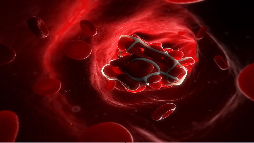 علماء يكشفون ارتباط كورونا بحالة غير طبيعية 