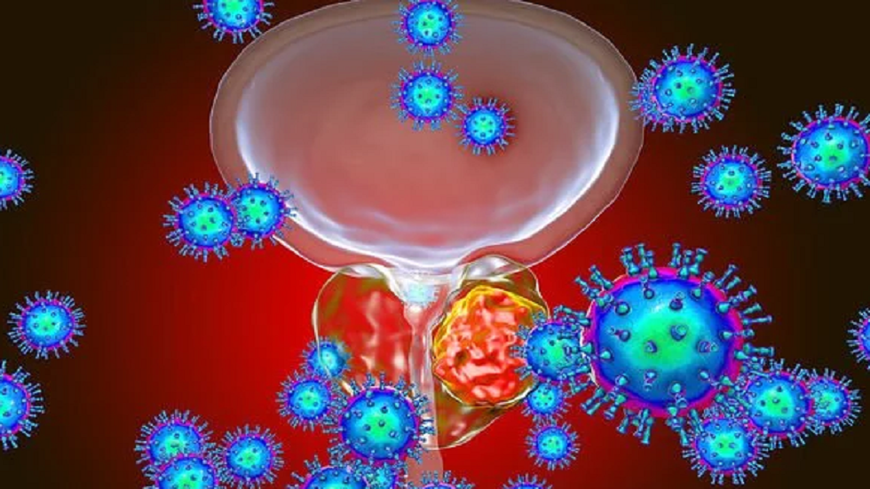 علامة تحذيرية في لون البول قد تدل على إصابة الرجال بسرطان خطير