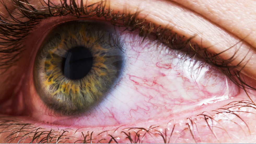 علماء يحذرون من إمكانية دخول فيروس كورونا عبر العيون!