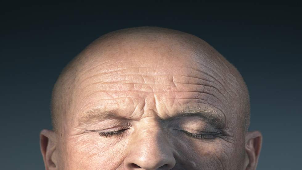 علماء يحققون إنجازا هاما نحو علاج الصلع نهائيا