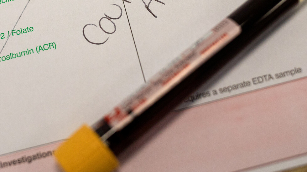 طوكيو تسجل 47 إصابة جديدة بفيروس كورونا