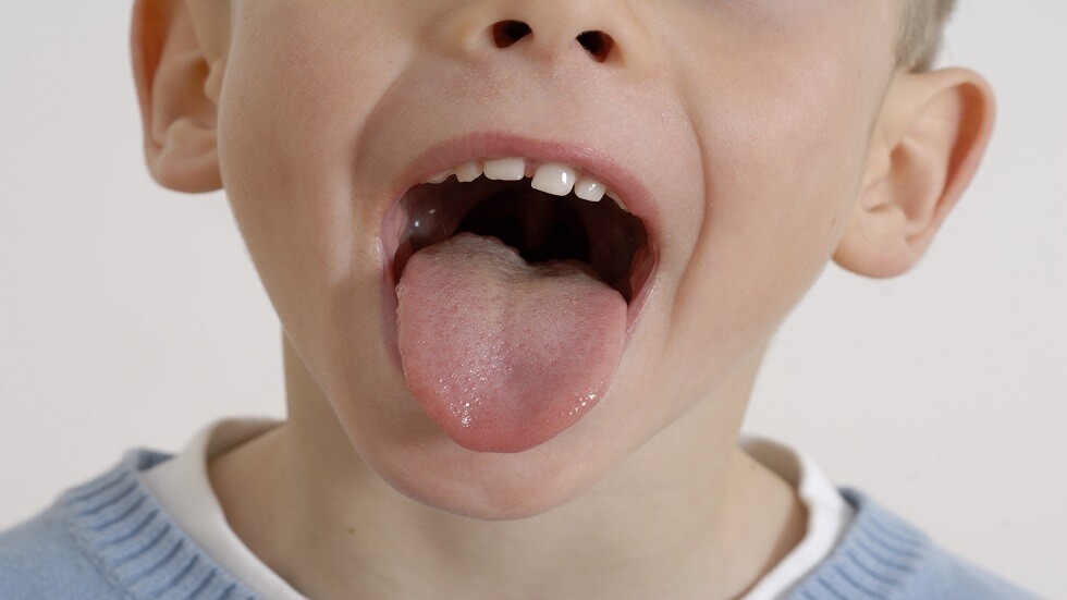 اللسان مرآة الصحة