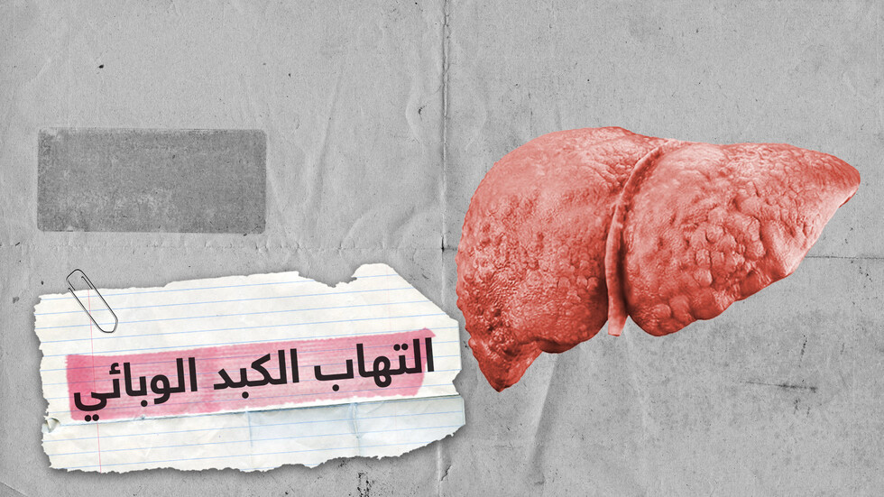 ماذا تعرف عن فيروسات التهاب الكبد الوبائي؟