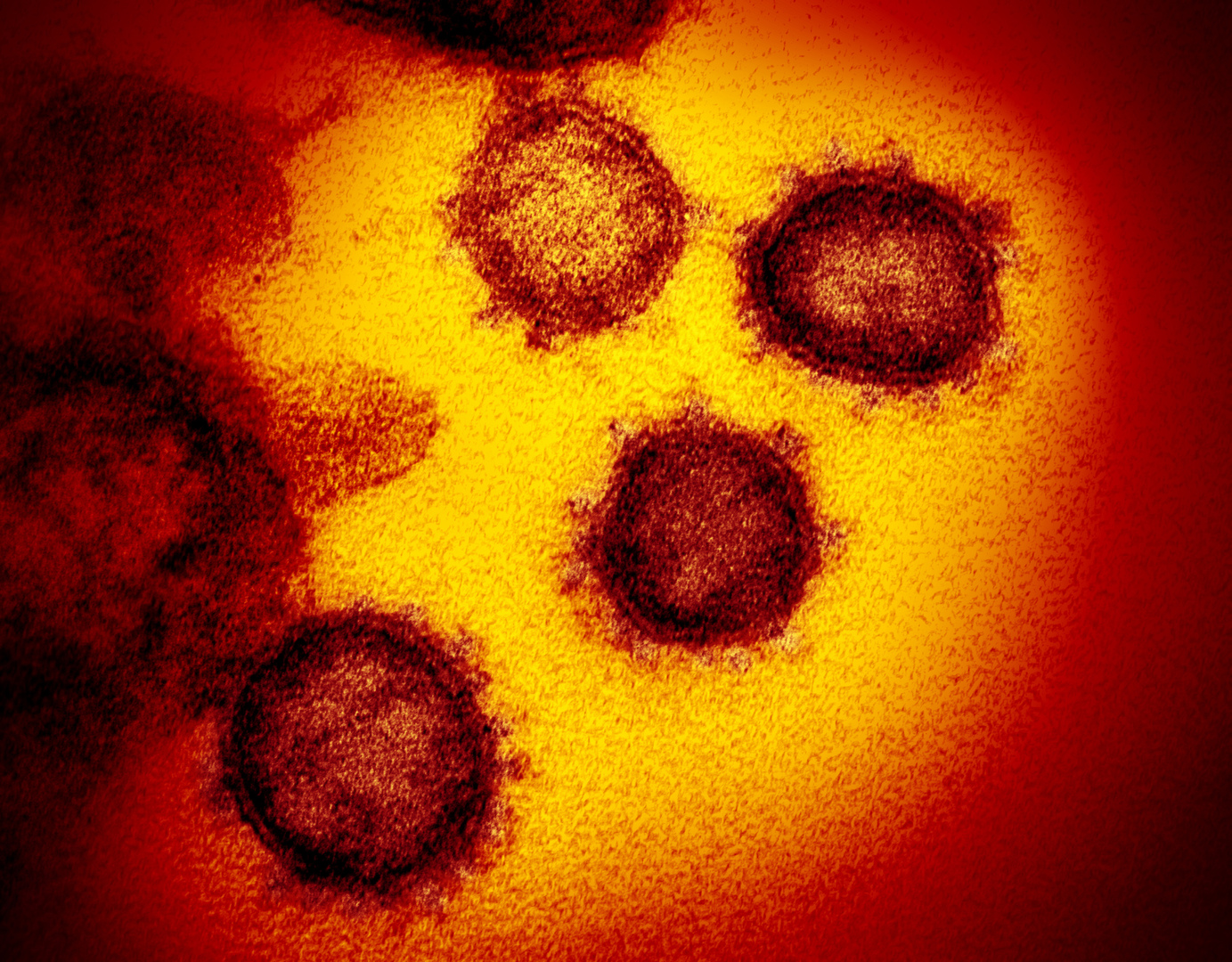 علماء أتراك يلتقطون صورة عالية الدقة لفيروس كورونا